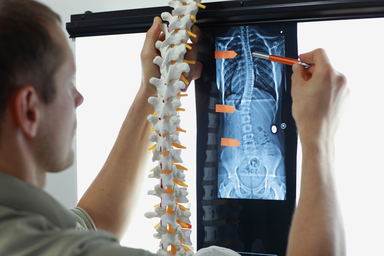 What are the Four Types of Spinal Cord Injury? 